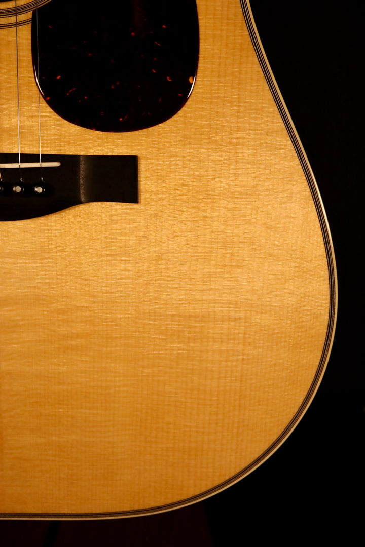 Santa Cruz D Model Custom - Old Growth Adirondack/Indian Rosewood/LR Baggs Anthem Pickup (NEW)
